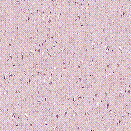 Imagenes y texturas de Superficies Punteadas y Rugosas